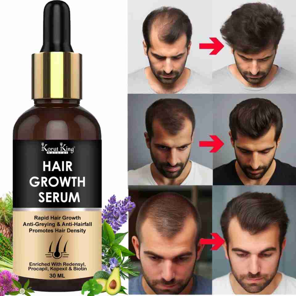 KORAT KING Hair Growth Serum 3% Redensyl - Image 6