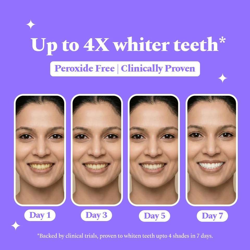 RJD1114 Teeth Whitening Strips with PAP - Image 7