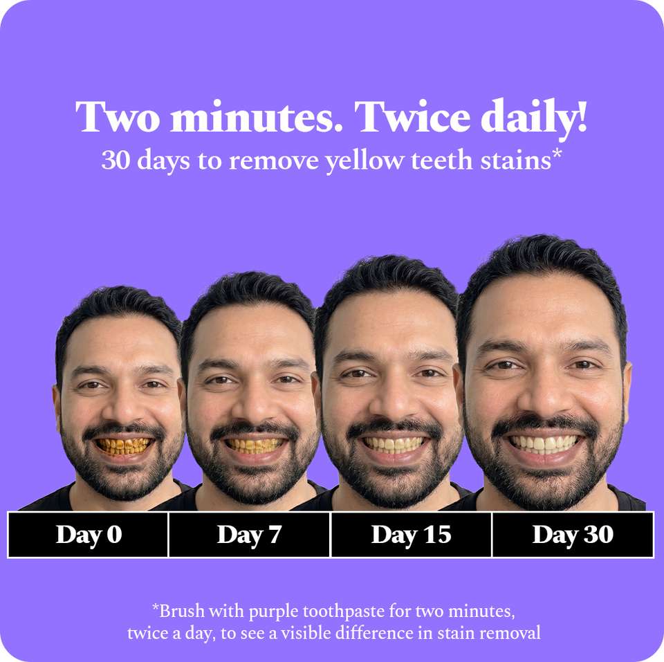 Perfora Purple Whitening Toothpaste - Image 8